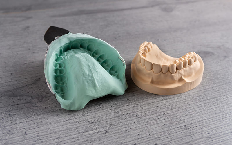 当院の入れ歯のこだわり